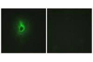 Immunofluorescence analysis of HeLa cells, using Collagen VI α3 antibody. (COL6a3 antibody)