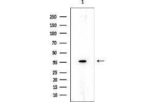 anti-Peropsin (RRH) (Internal Region) antibody