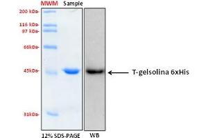 Western Blotting (WB) image for Gelsolin (GSN) (AA 404-782), (C-Term) protein (His tag) (ABIN5675805)