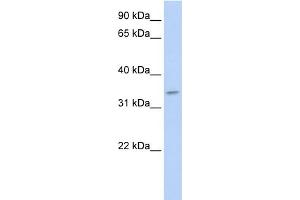 WB Suggested Anti-TNMD Antibody Titration:  0. (TNMD antibody  (N-Term))