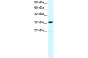 Western Blotting (WB) image for anti-Chromobox Homolog 4 (CBX4) antibody (ABIN2460142) (CBX4 antibody)