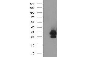 HEK293T cells were transfected with the pCMV6-ENTRY control (Left lane) or pCMV6-ENTRY EIF4E2 (Right lane) cDNA for 48 hrs and lysed. (EIF4E2 antibody)