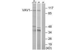 Western blot analysis of extracts from Jurkat cells, using VAV1 (Ab-174) antibody. (VAV1 antibody  (Tyr174))
