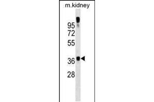 Western blot analysis in mouse kidney tissue lysates (35ug/lane). (GTF2A1 antibody  (C-Term))
