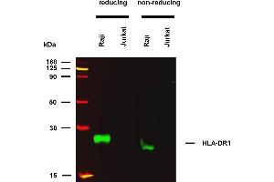 Anti-HLA-DR1 (empty) (clone MEM-267) works in WB application under reducing and non-reducing conditions. (HLA-DR1 antibody)