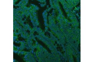 IF analysis of SEC22B using anti-SEC22B antibody (ABIN7602121). (SEC22B antibody  (AA 6-197))