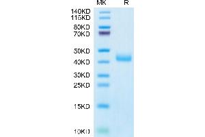 CCR8 Protein (AA 1-35) (Fc Tag)