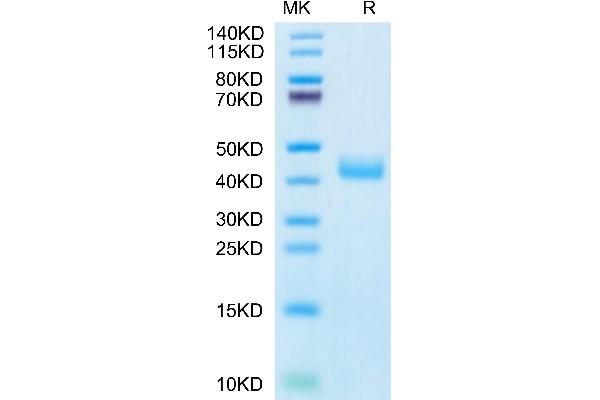 CCR8 Protein (AA 1-35) (Fc Tag)