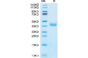 Human CCR8 on Tris-Bis PAGE under reduced condition. (CCR8 Protein (AA 1-35) (Fc Tag))