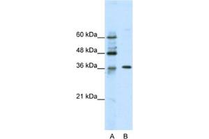 Western Blotting (WB) image for anti-Zinc Finger Protein 124 (ZNF124) antibody (ABIN2461697) (ZNF124 antibody)