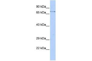 FBXW8 antibody used at 1 ug/ml to detect target protein. (FBXW8 antibody  (Middle Region))