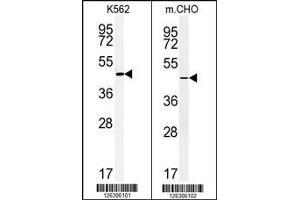 (LEFT)Western blot analysis of ENTPD8 Antibody in K562 cell line lysates (35ug/lane).