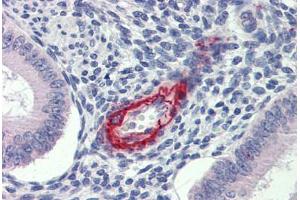 Uterus, Human: Formalin-Fixed, Paraffin-Embedded (FFPE) (DDAH2 antibody  (N-Term))