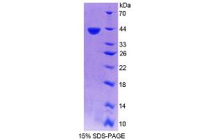 SDS-PAGE (SDS) image for Jumonji Domain Containing 6 (JMJD6) (AA 1-334) protein (His tag) (ABIN4988927) (JMJD6 Protein (AA 1-334) (His tag))