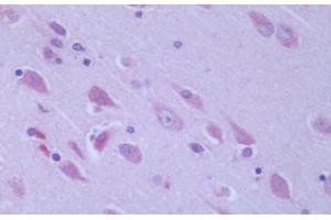 Human Brain, Cortex: Formalin-Fixed, Paraffin-Embedded (FFPE) (GPR6 antibody  (Cytoplasmic Domain))