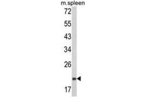 Western blot analysis of PSMA7 Antibody (Center) in mouse spleen tissue lysates (35ug/lane). (PSMA7 antibody  (Middle Region))