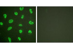 Forskolin + -Immunofluorescence analysis of HeLa cells, treated with Forskolin (40nM, 30mins), using DNA-PK antibody. (PRKDC antibody)