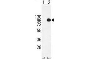 Western Blotting (WB) image for anti-Mucin 20, Cell Surface Associated (MUC20) antibody (ABIN2995265) (MUC20 antibody)
