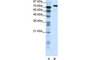 Western Blotting (WB) image for anti-SATB Homeobox 1 (SATB1) antibody (ABIN2461672) (SATB1 antibody)