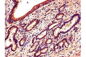 Immunohistochemistry of paraffin-embedded human pancreatic tissue using ABIN7151870 at dilution of 1:100 (EPH Receptor B6 antibody  (AA 410-553))