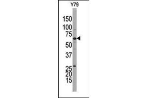 Western blot analysis of anti-GUCY1B3 Pab(AP8171b) in Y79 cell line lysate. (Guanylyl Cyclase beta 1 antibody)