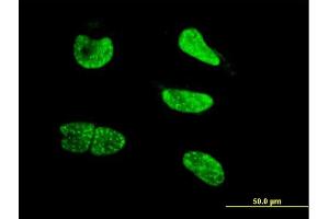 Immunofluorescence of monoclonal antibody to NEUROG3 on HeLa cell. (Neurogenin 3 antibody  (AA 1-101))