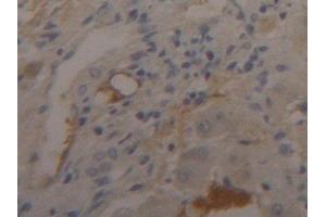 Detection of FGB in Human Liver Tissue using Polyclonal Antibody to Fibrinogen Beta Chain (FGB) (Fibrinogen beta Chain antibody  (AA 29-491))