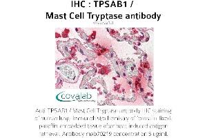 Image no. 1 for anti-Tryptase alpha/beta 1 (TPSAB1) antibody (ABIN1723158) (TPSAB1 antibody)