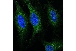 Image kindly submitted by an end-user via Funakoshi. (Cytochrome C antibody  (AA 51-105))
