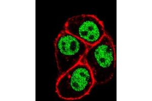 Confocal immunofluorescent analysis of CDC73 Antibody (Center) (ABIN653128 and ABIN2842707) with Hela cell followed by Alexa Fluor 488-conjugated goat anti-rabbit lgG (green). (HRPT2 antibody  (AA 132-161))