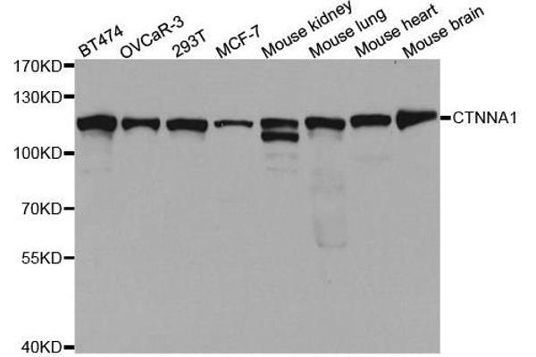 CTNNA1 anticorps  (AA 637-906)