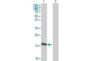 Western Blot analysis of SSNA1 expression in transfected 293T cell line by SSNA1 MaxPab polyclonal antibody. (SSNA1 antibody  (AA 1-119))