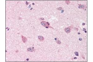 Immunohistochemistry (IHC) image for anti-Amyloid beta (A4) Precursor Protein (APP) (AA 18-289) antibody (ABIN317496) (APP antibody  (AA 18-289))