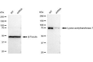 Western blotting analysis using Lysine acetyltransferase 7 antibody (ABIN7799528). (Recombinant MYST2 antibody)
