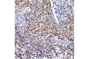 Immunohistochemistry of paraffin-embedded human placenta using [KO Validated] CD73/NT5E Rabbit pAb (ABIN3022733, ABIN3022734, ABIN3022735, ABIN1513283 and ABIN6219201) at dilution of 1:50 (40x lens). (CD73 antibody  (AA 290-550))