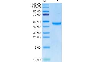Human TSPAN8 on Tris-Bis PAGE under reduced condition. (Tspan-8 Protein (AA 110-205) (Fc Tag))