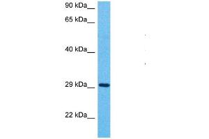 Host:  Rabbit  Target Name:  MFF  Sample Type:  Stomach Tumor lysates  Antibody Dilution:  1. (MFF antibody  (C-Term))
