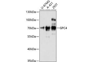 Western blot analysis of extracts of various cell lines, using GPC4 antibody (ABIN6127961, ABIN6141311, ABIN6141312 and ABIN6216562) at 1:3000 dilution. (GPC4 antibody  (AA 357-556))