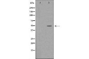 Western blot analysis of extracts of HepG2, using CFH antibody.