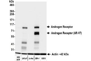 Western Blotting (WB) image for anti-Androgen Receptor (AR) (AA 1-50) antibody (ABIN7795784)