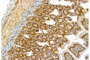 ABIN6265767 and ABIN6278388 at 1/100 staining Rat colon tissue by IHC-P. (TSG101 antibody  (Internal Region))
