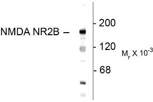 Western blots of 10 ug of rat hippocampal lysate showing specific immunolabeling of the ~180k NR2B subunit of the NMDA receptor. (GRIN2B antibody  (N-Term))