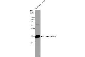 WB Image Human tissue extract (30 μg) was separated by 15% SDS-PAGE, and the membrane was blotted with Transthyretin antibody [N1C3] , diluted at 1:500. (TTR antibody)
