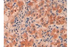 Detection of CTH in Human Stomach Tissue using Polyclonal Antibody to Cystathionine (CTH) (Cystathionine (AA 163-382) antibody)