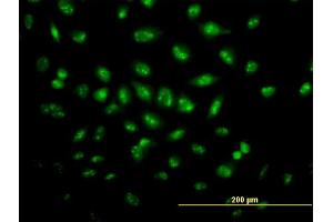 Immunofluorescence of monoclonal antibody to TP53RK on HeLa cell. (TP53RK antibody  (AA 154-253))