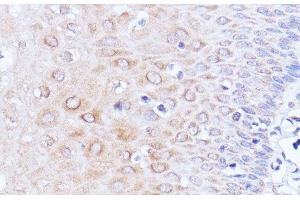 Immunohistochemistry of paraffin-embedded Human esophageal using Polyclonal AntibodyPC1 Polyclonal Antibody at dilution of 1:100 (40x lens). (PC1 antibody)