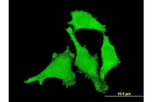Immunofluorescence of monoclonal antibody to ANKRD17 on HeLa cell. (ANKRD17 antibody  (AA 2501-2603))