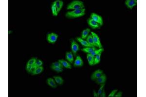 Immunofluorescence staining of HepG2 cells with ABIN7157984 at 1:66, counter-stained with DAPI. (Mip (AA 220-263) antibody)