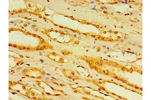 Immunohistochemistry of paraffin-embedded human kidney tissue using ABIN7158862 at dilution of 1:100 (DCP2 antibody  (AA 1-385))