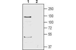 Western blot analysis of human HL-60 promyelocytic leukemia cell lysates: - 1. (ADGRB1 antibody  (Extracellular))